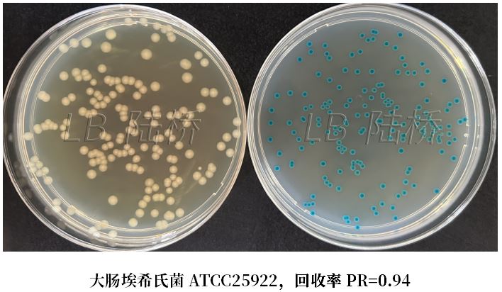 GB 4789.38-2025《食品安全國家標(biāo)準(zhǔn) 食品微生物學(xué)檢驗 大腸埃希氏菌計數(shù)》解讀 GB 4789.38-2025《食品安全國家標(biāo)準(zhǔn) 食品微生物學(xué)檢驗 大腸埃希氏菌計數(shù)》解讀