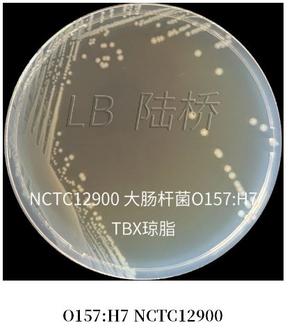 GB 4789.38-2025《食品安全國家標(biāo)準(zhǔn) 食品微生物學(xué)檢驗 大腸埃希氏菌計數(shù)》解讀 GB 4789.38-2025《食品安全國家標(biāo)準(zhǔn) 食品微生物學(xué)檢驗 大腸埃希氏菌計數(shù)》解讀